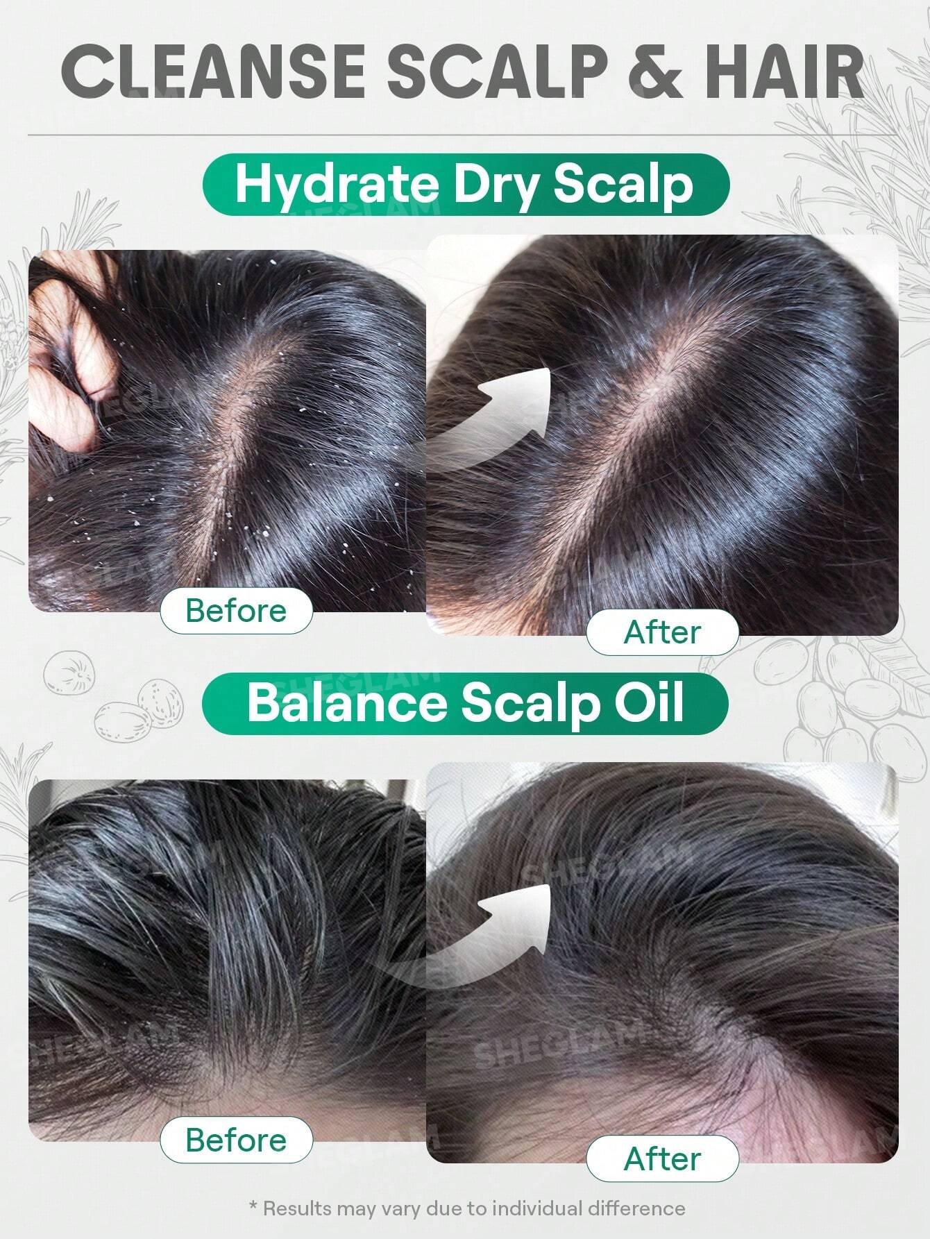 Aceite de romero para cabello y cuero cabelludo - 15 ml